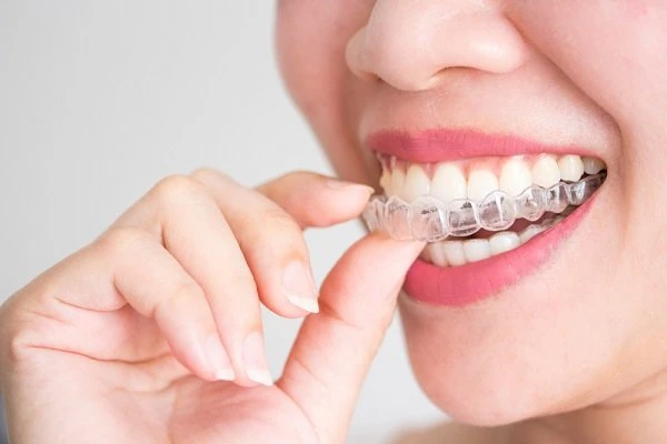 Vệ sinh khay niềng đúng cách sẽ hạn chế được những rủi ro liên quan đến sức khỏe răng miệng